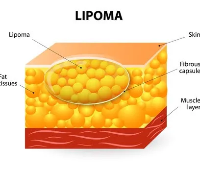 Natural healing support